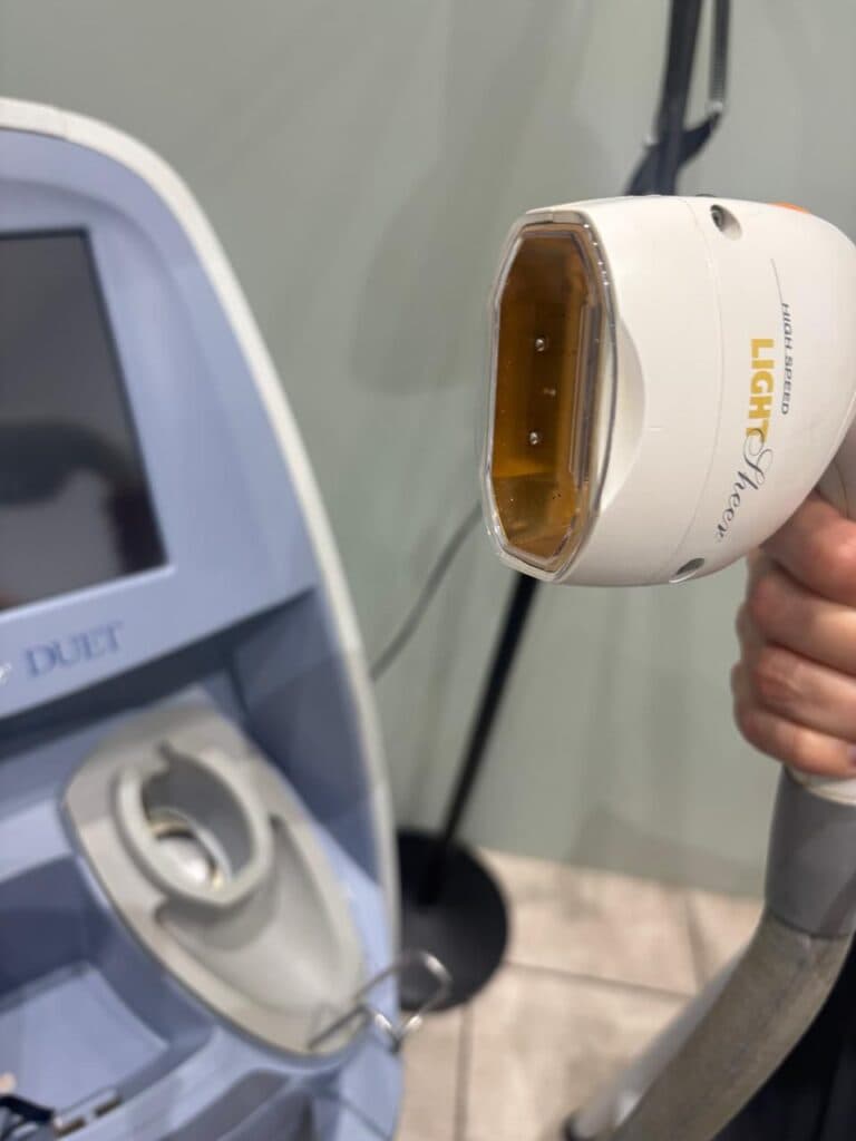 Cryo Sheer Laser Technology 3