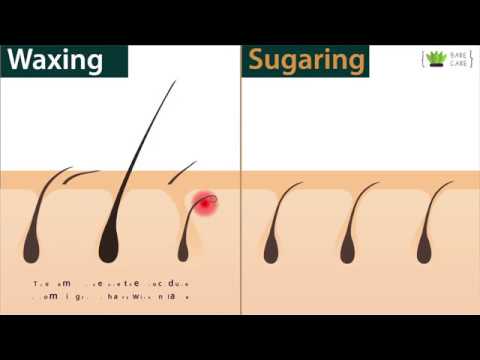Post-Waxing Ingrown Hairs: Why They Happen and What Helps